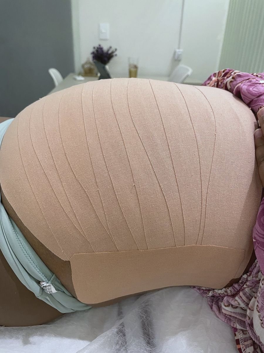 Taping aplicado na barriga durante a gestação
